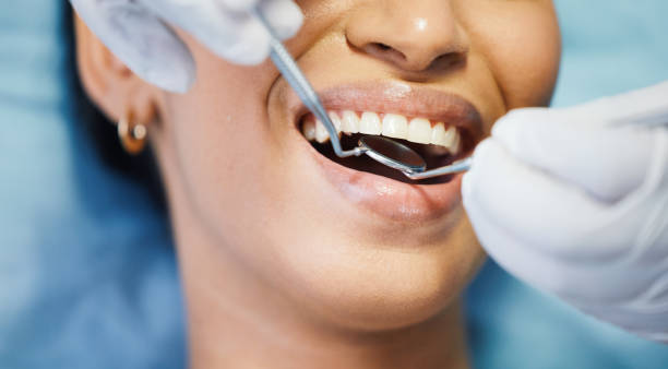 Best Emergency Tooth Extraction in Greenville, MS